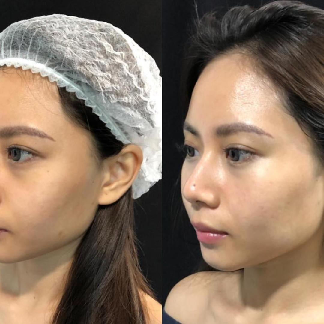 Sungboon Editor Deep Collagen Power Boosting Duo | Cream in Serum + Hydrogel Mask | 5% Volufiline + 58% Low-Molecular Collagen | Anti-Wrinkle, Firming & Instant Glow