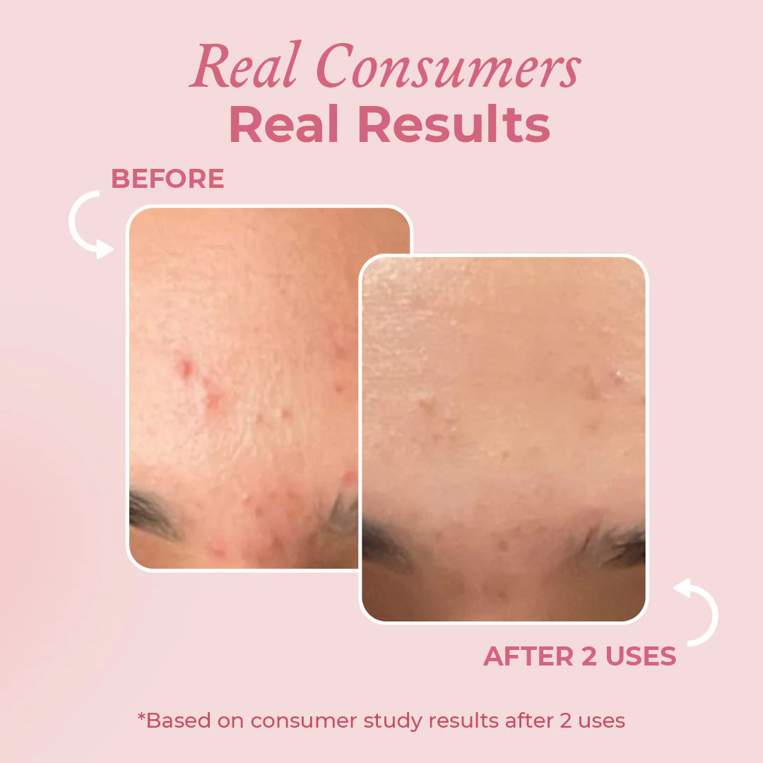 Anua Crystal Glow Duo: Rice Enzyme Brightening Cleansing Powder & PDRN Collagen Capsule Mist | Deep Hydration + Glass Skin Set
