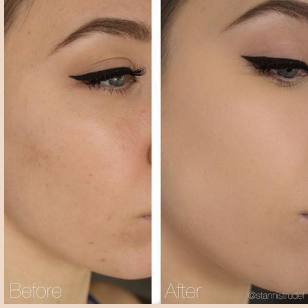 MARS Liquid Blossom Foundation & Concealer Set | SPF 50+ PA++++, Longwear, Crease-Resistant & Customizable Coverage