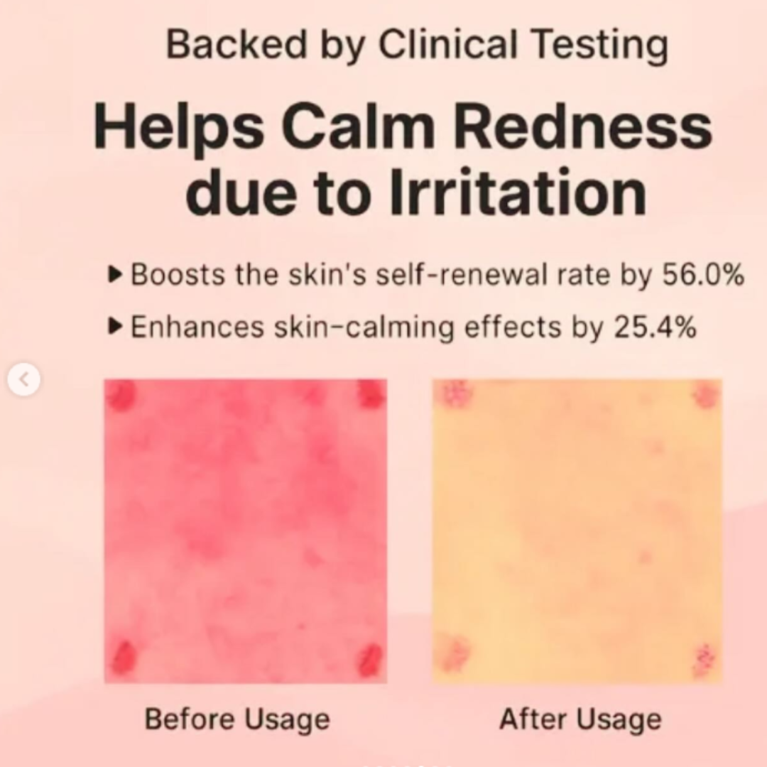 Reju-all PDRN Cream - Remove dark spots, blemishes, dry - patches & give glowing smooth & hydrated skin