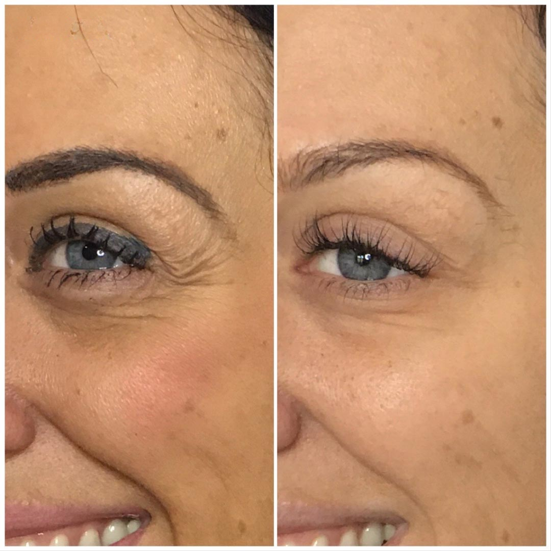 Anua PDRN + Hyaluronic Acid 100 Moisturizing Cream – Deep Hydration & Skin Plumping Cream for Glass Skin