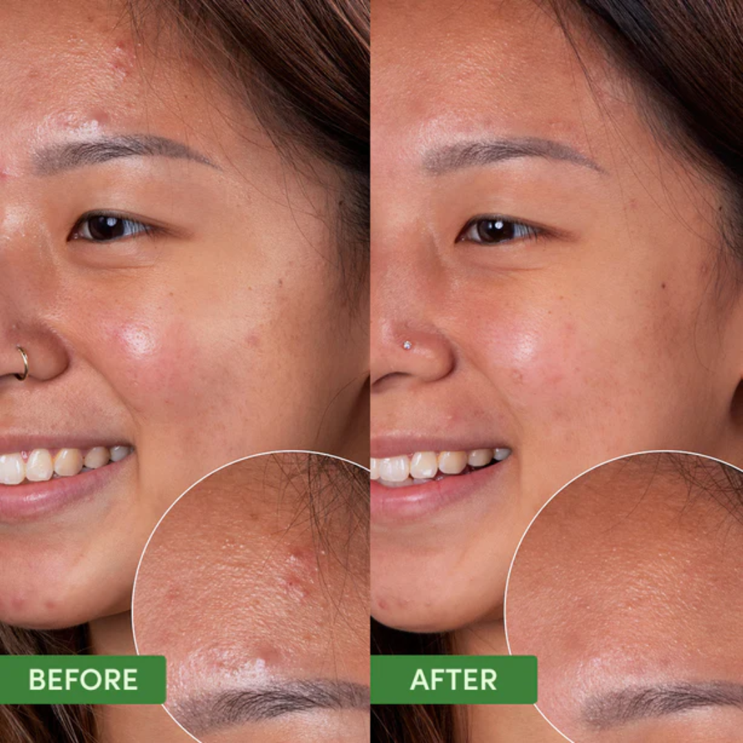 AXIS-Y Triple PDRN Gel Toner | 6+1+1 Advanced Formula with Plant-Based PDRN, Astaxanthin & Vegan Collagen | Strengthens Barrier, Hydrates & Calms Skin