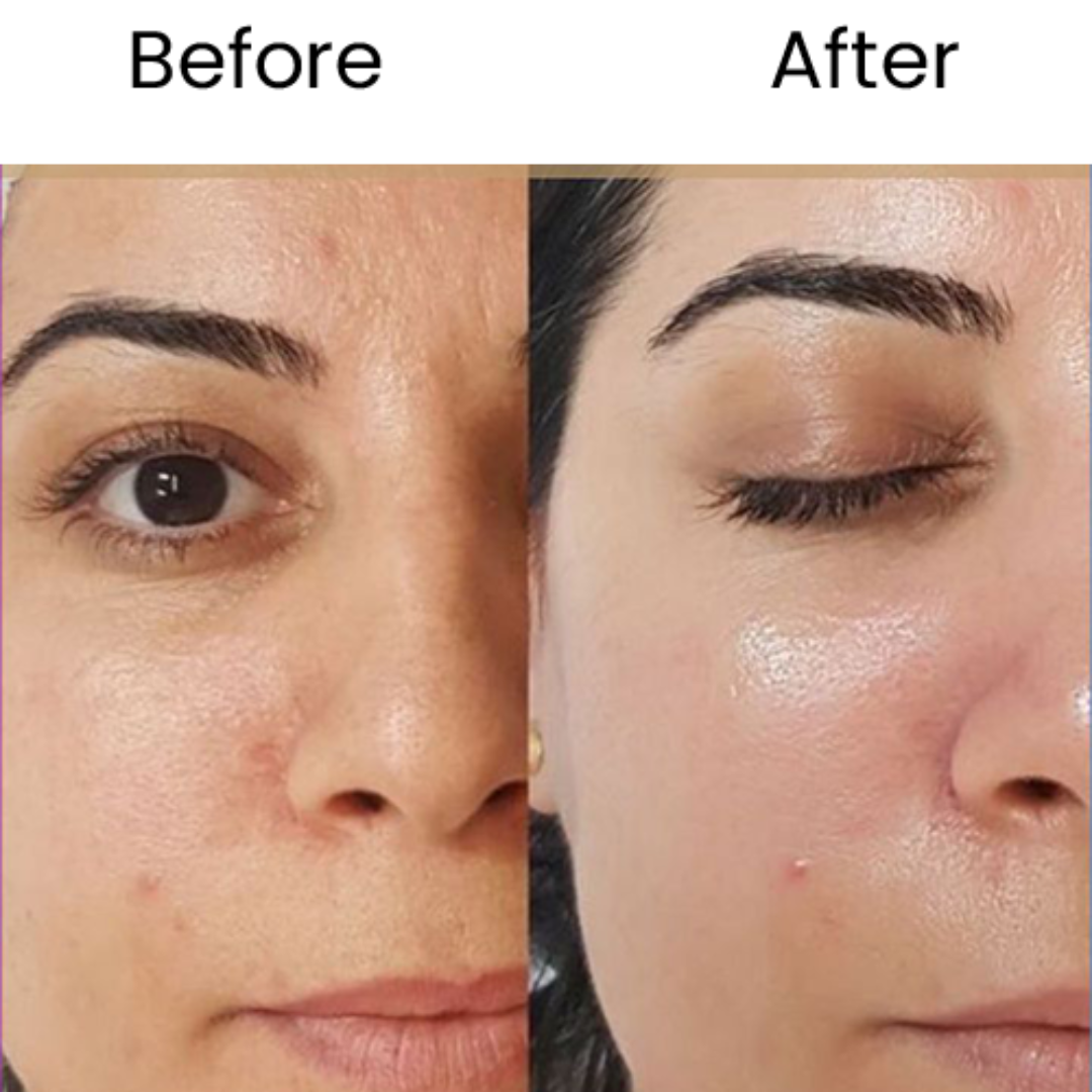 10 steps instant bridal Glow Facial Kit | Remove blackheads, Shirk Pores & Brighten up skin visibly after single use
