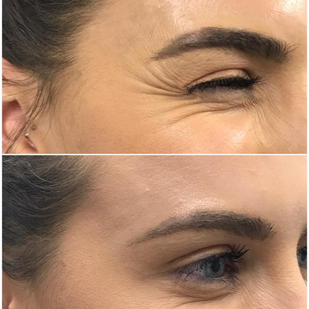 Anua PDRN + Hyaluronic Acid 100 Moisturizing Cream – Deep Hydration & Skin Plumping Cream for Glass Skin