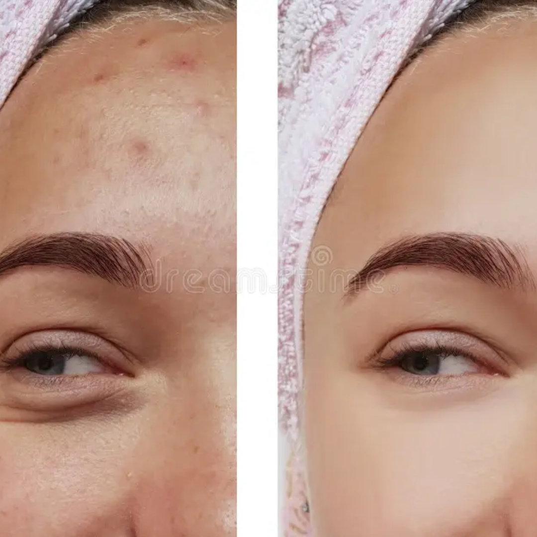 Sungboon Editor Deep Collagen Power Boosting Duo | Cream in Serum + Hydrogel Mask | 5% Volufiline + 58% Low-Molecular Collagen | Anti-Wrinkle, Firming & Instant Glow