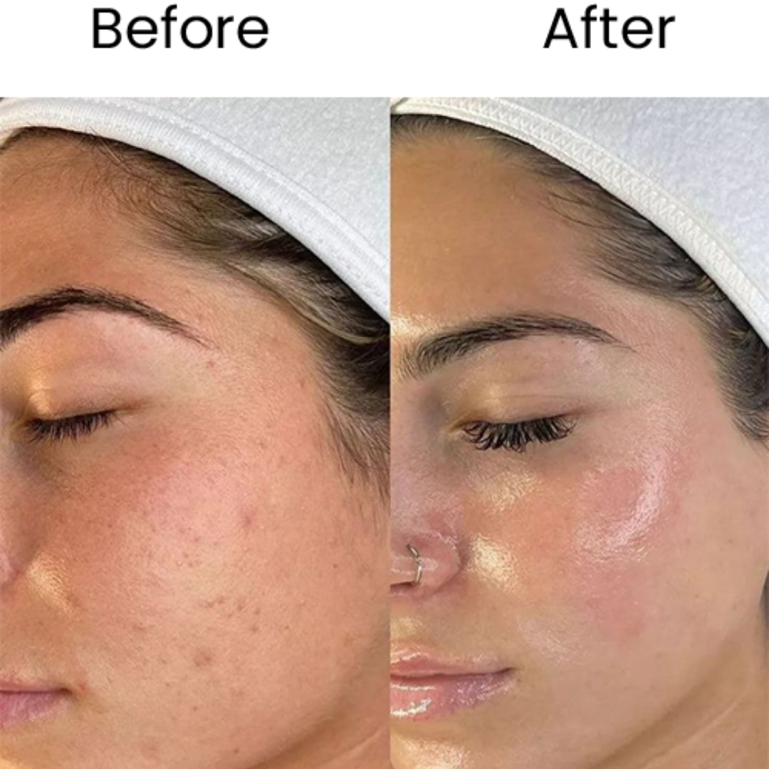 10 steps instant bridal Glow Facial Kit | Remove blackheads, Shirk Pores & Brighten up skin visibly after single use
