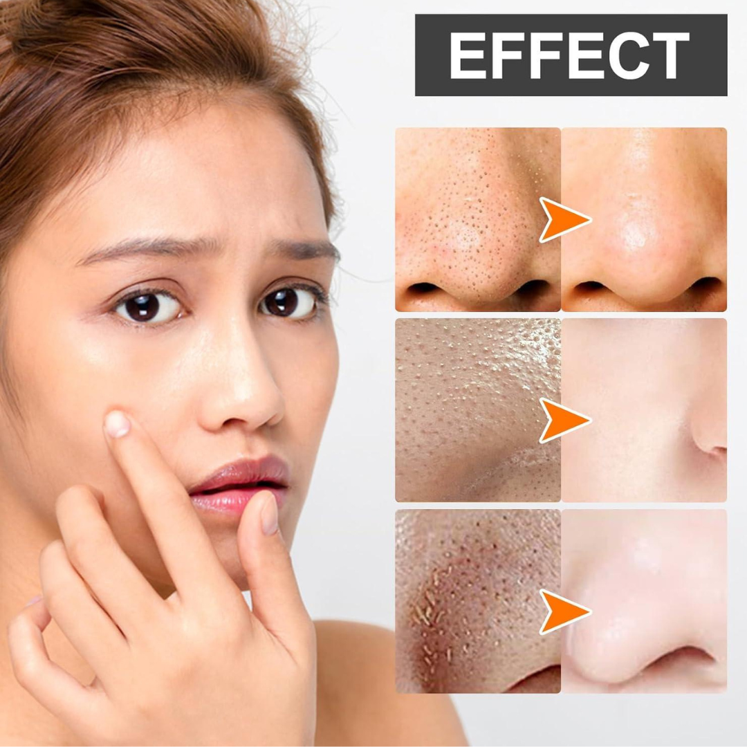 SKINTIFIC Alaska Volcano Pore Clay Stick | Glycolic Acid + Probiotic Complex + Collagen | Removes Blackheads, Tightens Pores & Smooths Skin