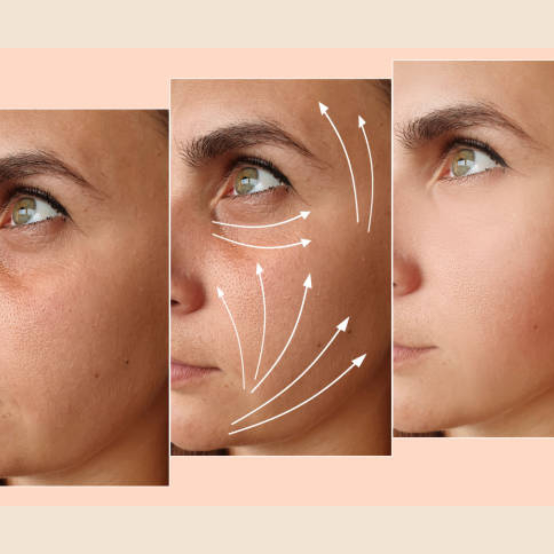 Reju-all PDRN Cream - Remove dark spots, blemishes, dry - patches & give glowing smooth & hydrated skin