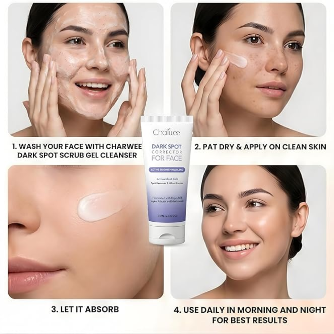 Dark Spot Corrector for Face – Fade Dark Spots Fast – Bright, Even Skin – Targets Sun Spots, Age Spots, Acne Marks & Freckle
