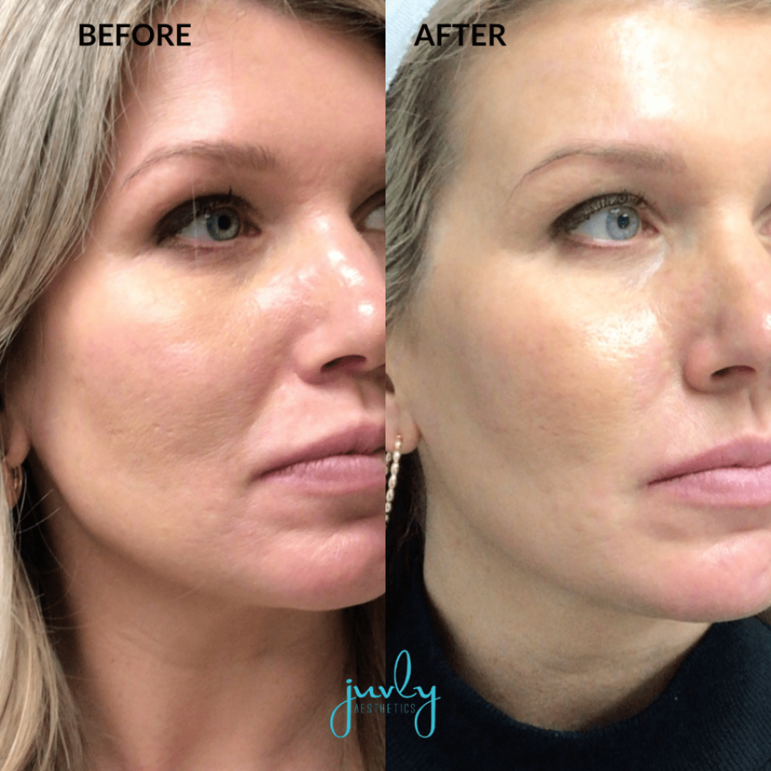 Magic fix Drops - Turn any foundation waterproof & 24H long-lasting