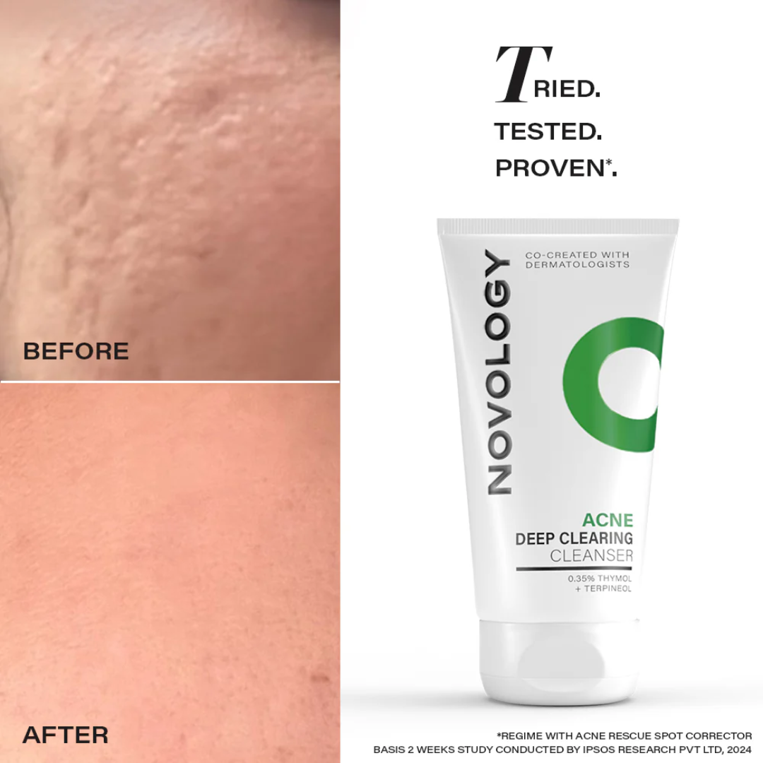 Novology Perfect Glow Cleanser – For Bright & Smooth Skin