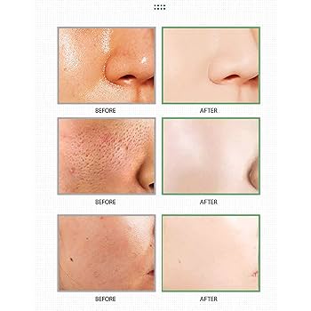 Madagascar Centella Clay Stick Mask - For Quick Pore Minimizing & whiteheads/Blackheads cleaning