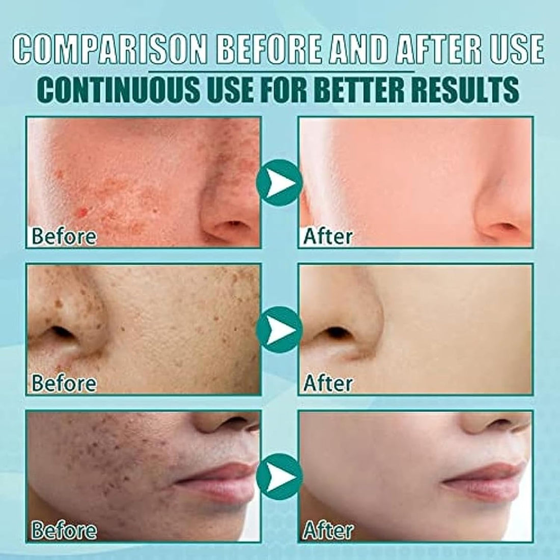 SL Basics Whitening Deal - Saffron cream + Gold serum for brightening