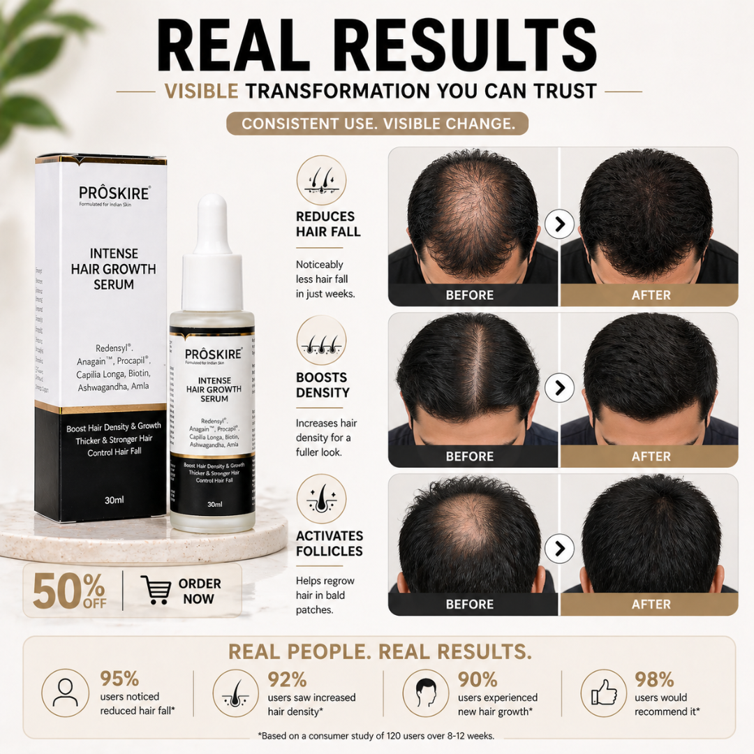 Proskire Hair Growth Serum – Reduces Hair Fall, Boosts Hair Density, Activates Follicles – For Bald Patches, Receding Hairline & Thinning Hair