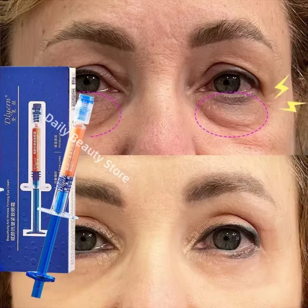 Anti-Wrinkle Firming Cream – Retinol + Peptides + Hyaluronic Acid – Reduces Fine Lines & Wrinkles, Firms & Lifts Skin, Boosts Collagen – For Eyes & Face