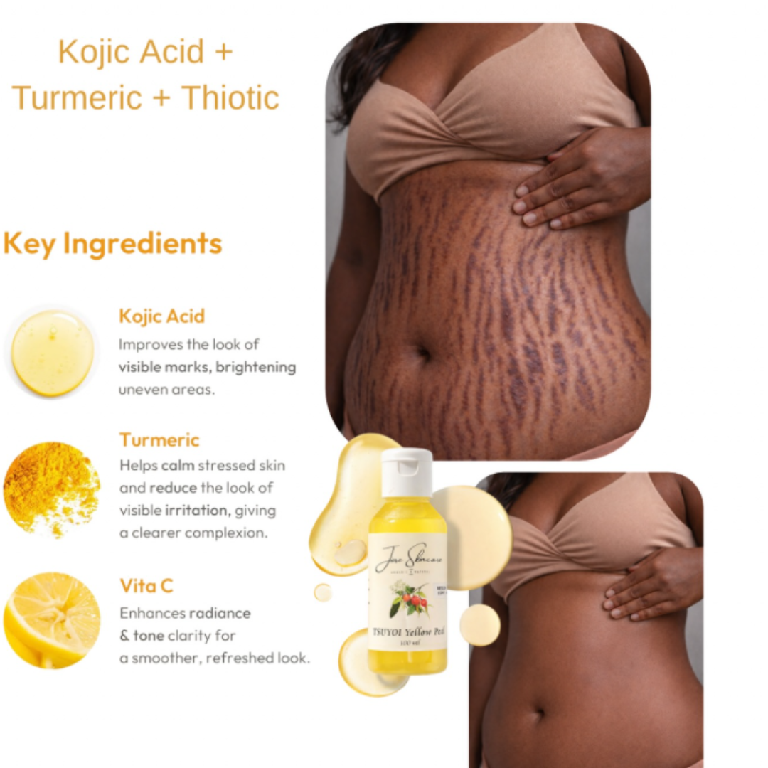 Jiore Tsuyoi Yellow Peel Body Oil | Organic & Natural with Kojic Acid, Turmeric, Thiotic Acid & AHA/BHA | Fades Stretch Marks, Peels Sun Tan & Brightens Skin
