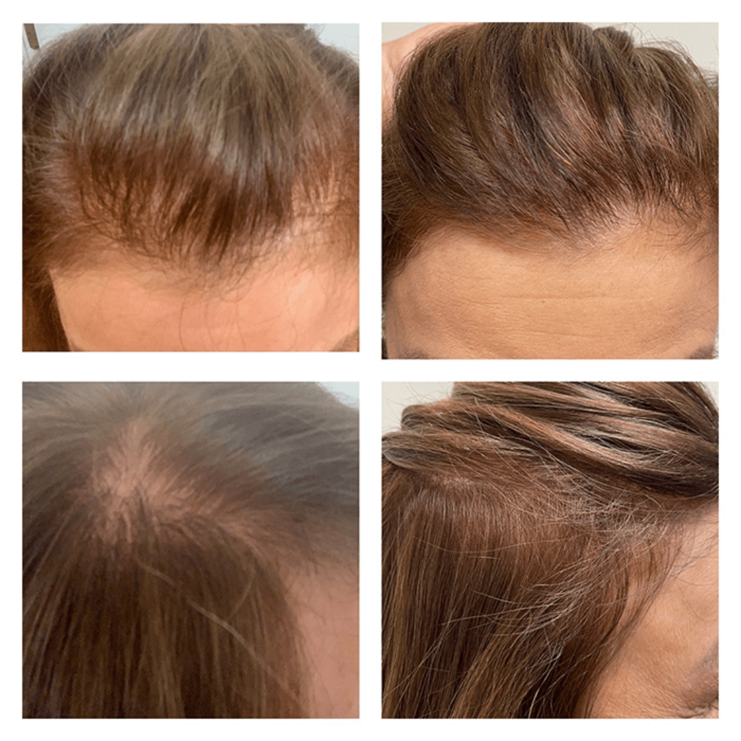 The Muse Labs Peptide Hair Growth Serum | Multi-Peptide Complex with Copper Peptides | Boosts Hair Growth, Reduces Hair Fall & Strengthens Roots