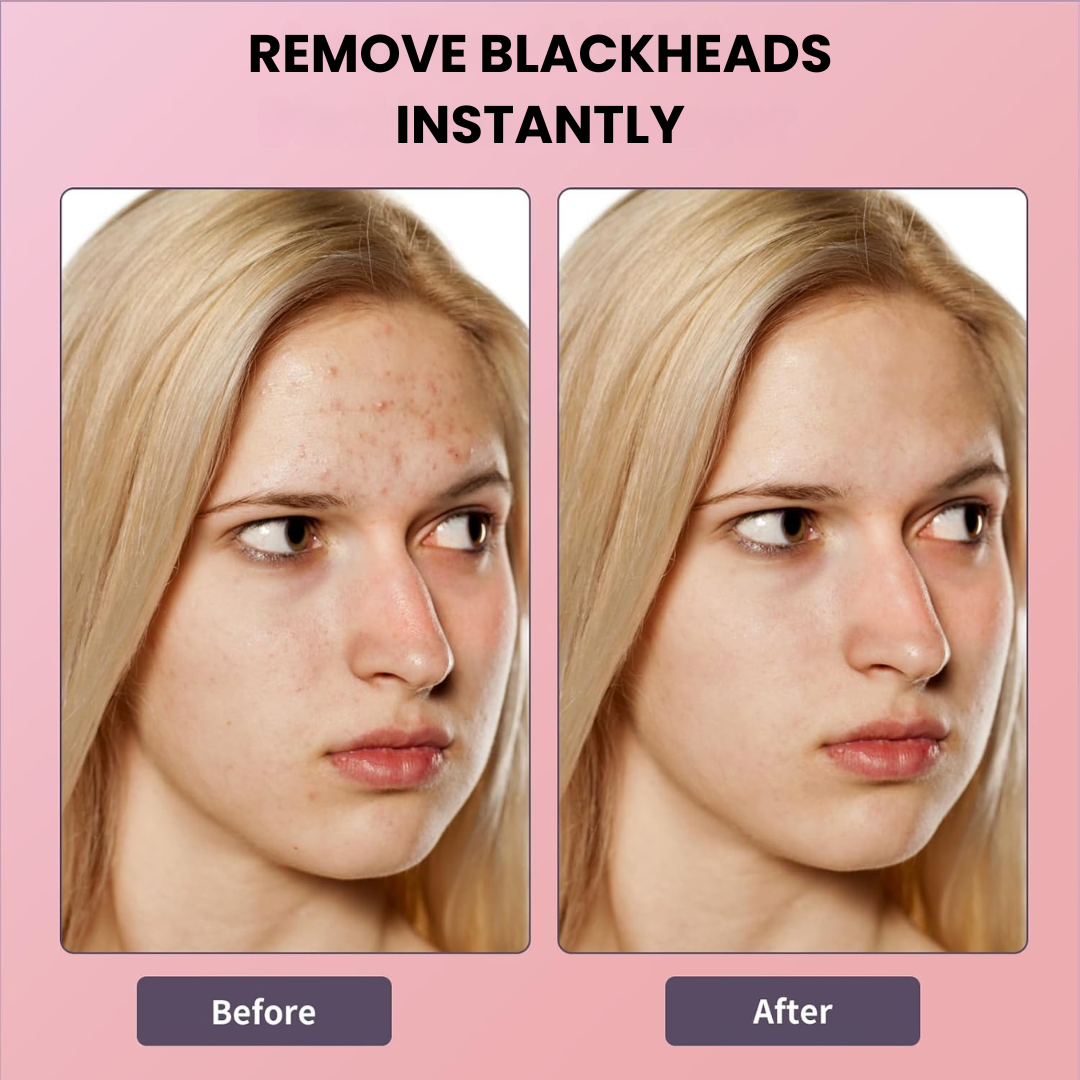 Mixsoon Bean Essence