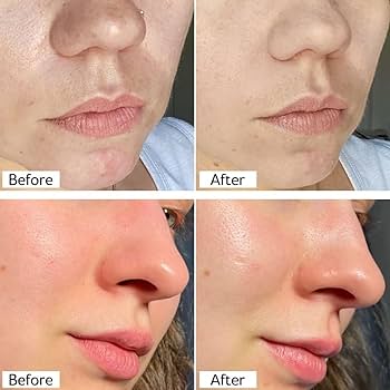 2-in-1 Rice  mask & cleanser (Remove black & white heads , tightening pores and give instant clean & bright skin tone)