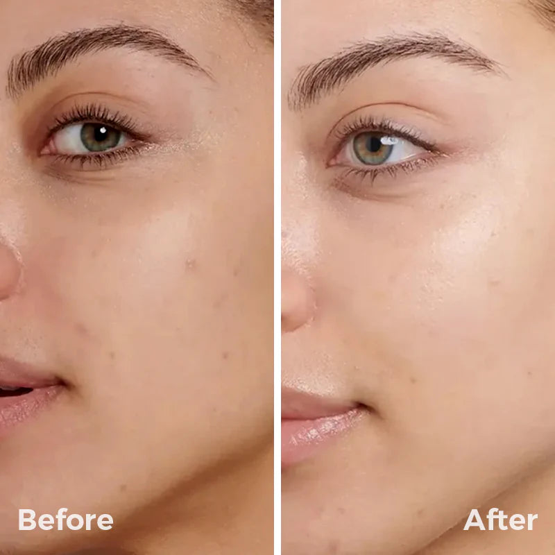 Xpose Full Coverage Foundation & Muse C Brightening Vitamin C Serum | Complete Skin-Perfecting Duo for Flawless, Radiant Skin