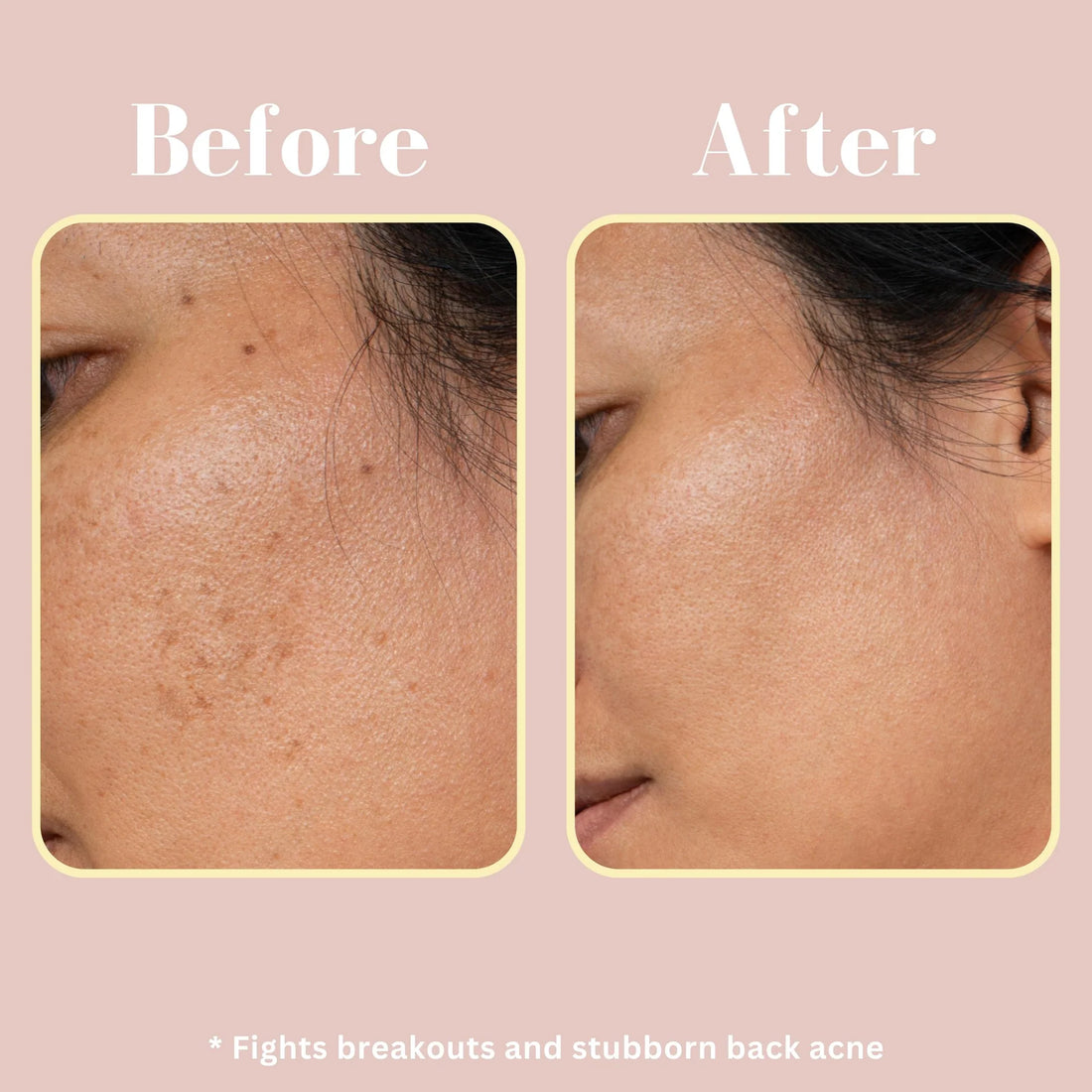 Mixsoon Bean Essence