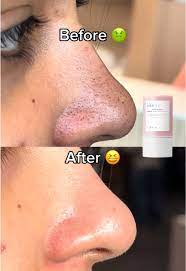 Madagascar Centella Clay Stick Mask - For Quick Pore Minimizing & whiteheads/Blackheads cleaning